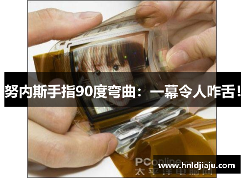 努内斯手指90度弯曲：一幕令人咋舌！